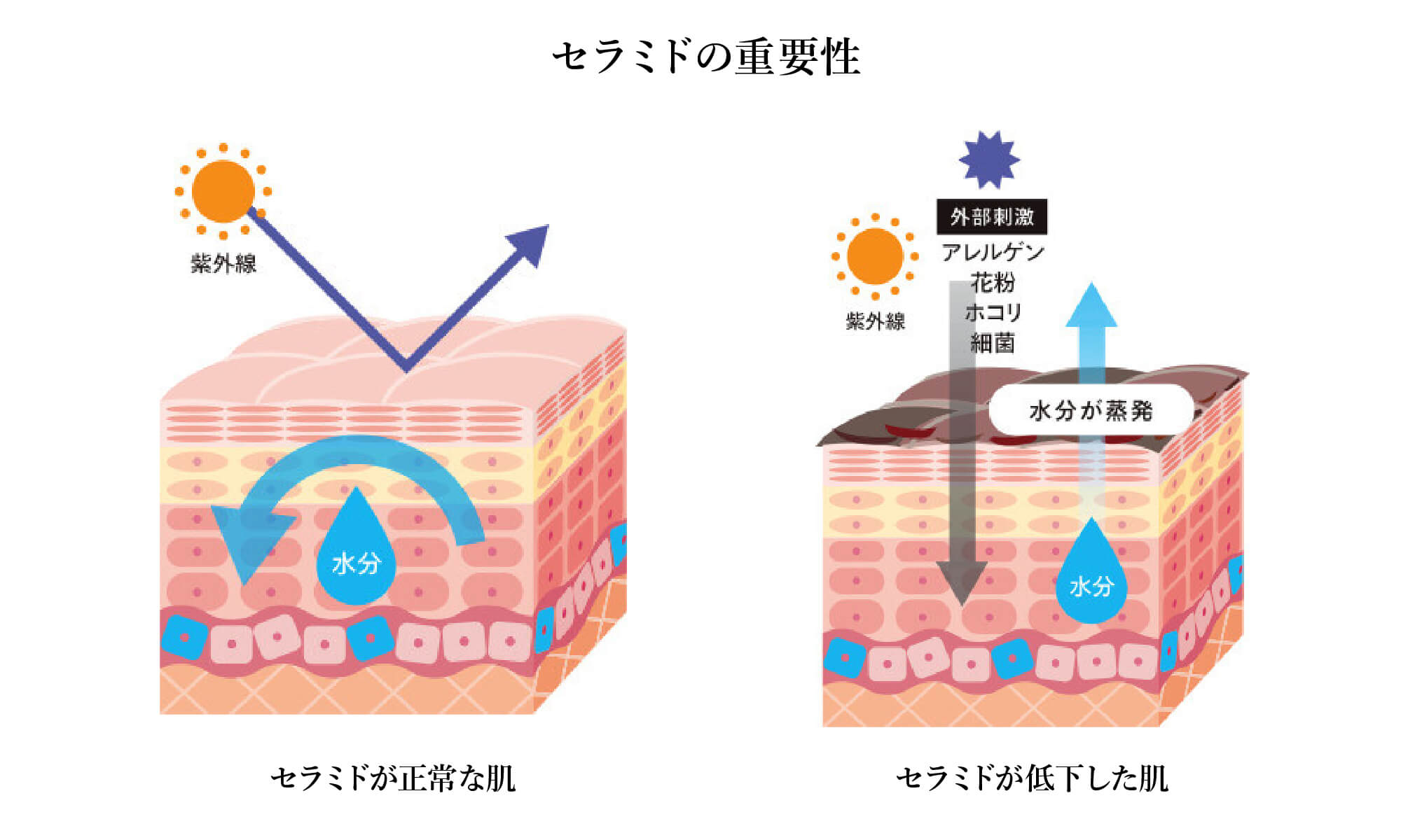 セラミドの重要性